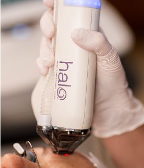 Halo laser treatment device in use.