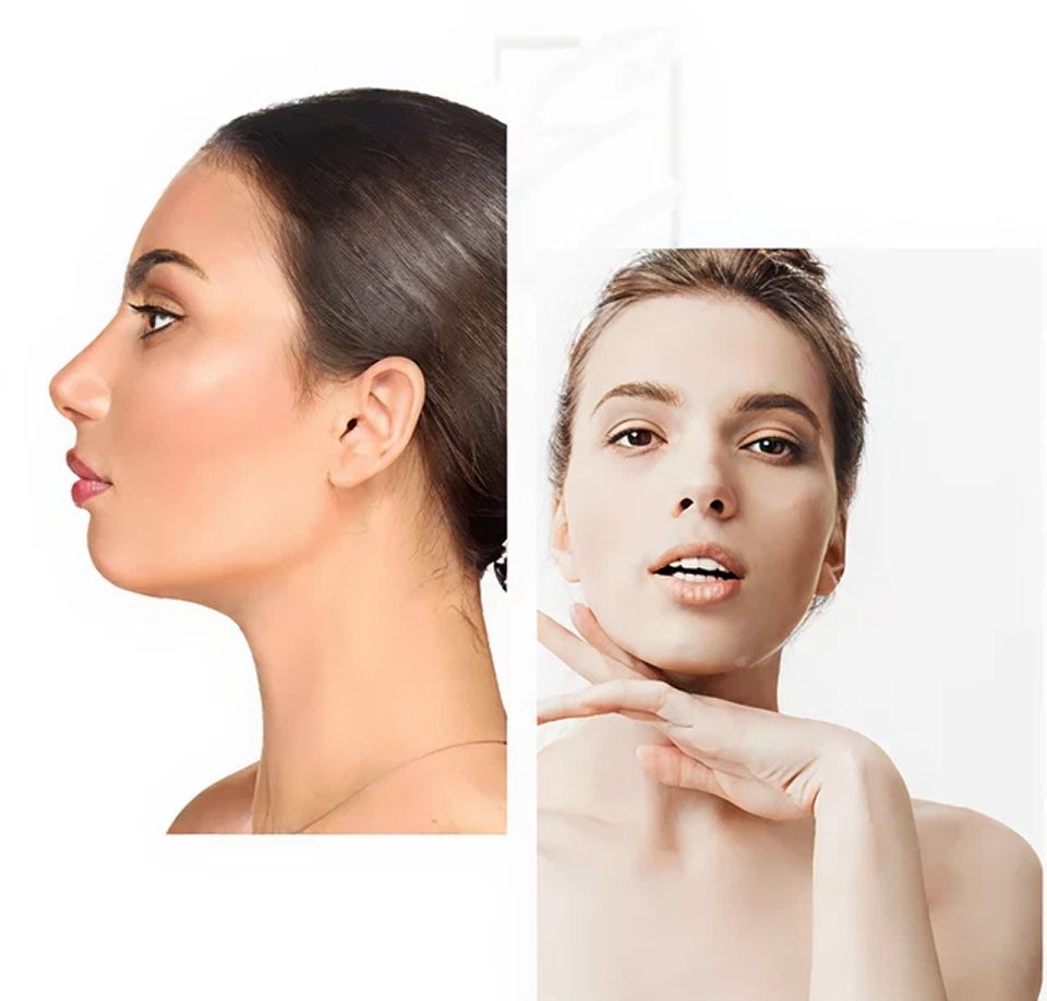 Two portraits of a woman, side profiles shown.
